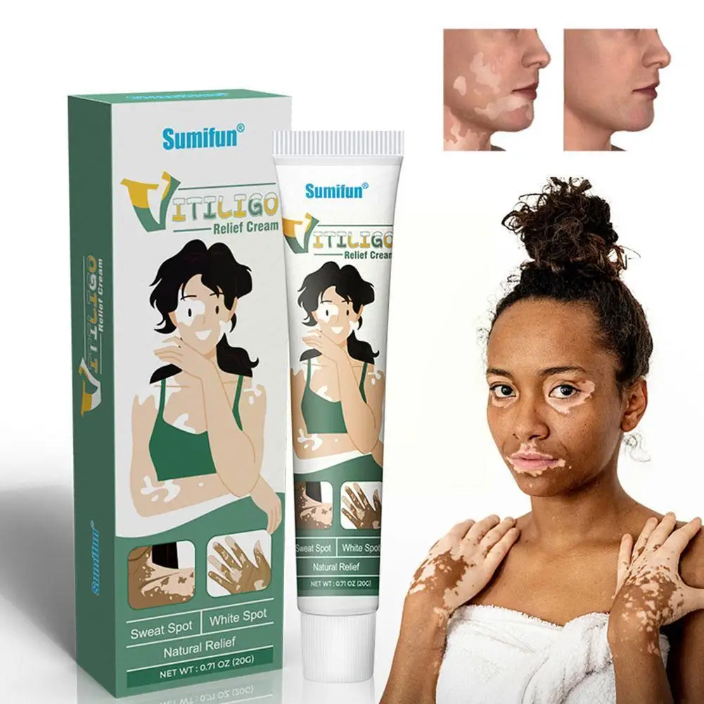 20 г травяной экстракт Vitiligo, мазь для удаления болезни, белое пятно, лейкоплакия, новый крем для лечения, удаления болезни, белый L3E0
20 г травяной экстракт Vitiligo, мазь для удаления болезни, белое пятно, лейкоплакия, новый крем для лечения, удаления болезни, белый L3E0
