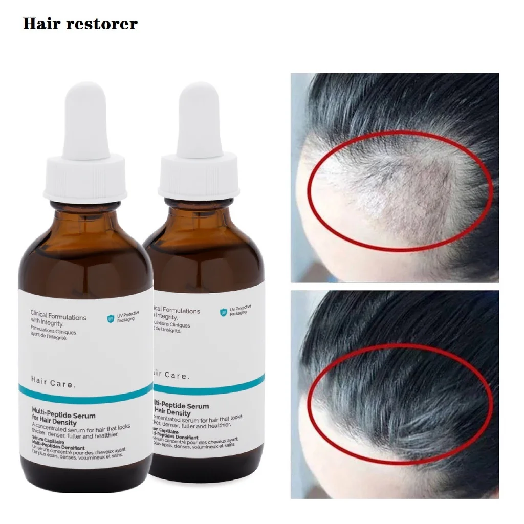 2PCS Hair Density Polypeptide Essence Protects Scalp And Improves Irritability And Damage Repair Essential Oil Hair Care 60ml
2PCS Hair Density Polypeptide Essence Protects Scalp And Improves Irritability And Damage Repair Essential Oil Hair Care 60ml