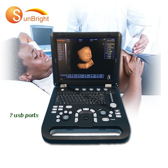 High quality portable Cardiac OB GYN 3D 4D Echocardiography ultrasound machine SUN-800D
High quality portable Cardiac OB GYN 3D 4D Echocardiography ultrasound machine SUN-800D