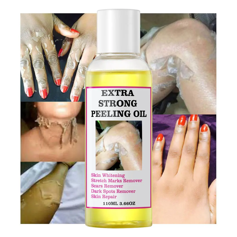 Powerful Yellow peeling oil soothes elbows, knees, hands, melanin, even skin tone, body skin care 110ml
Powerful Yellow peeling oil soothes elbows, knees, hands, melanin, even skin tone, body skin care 110ml