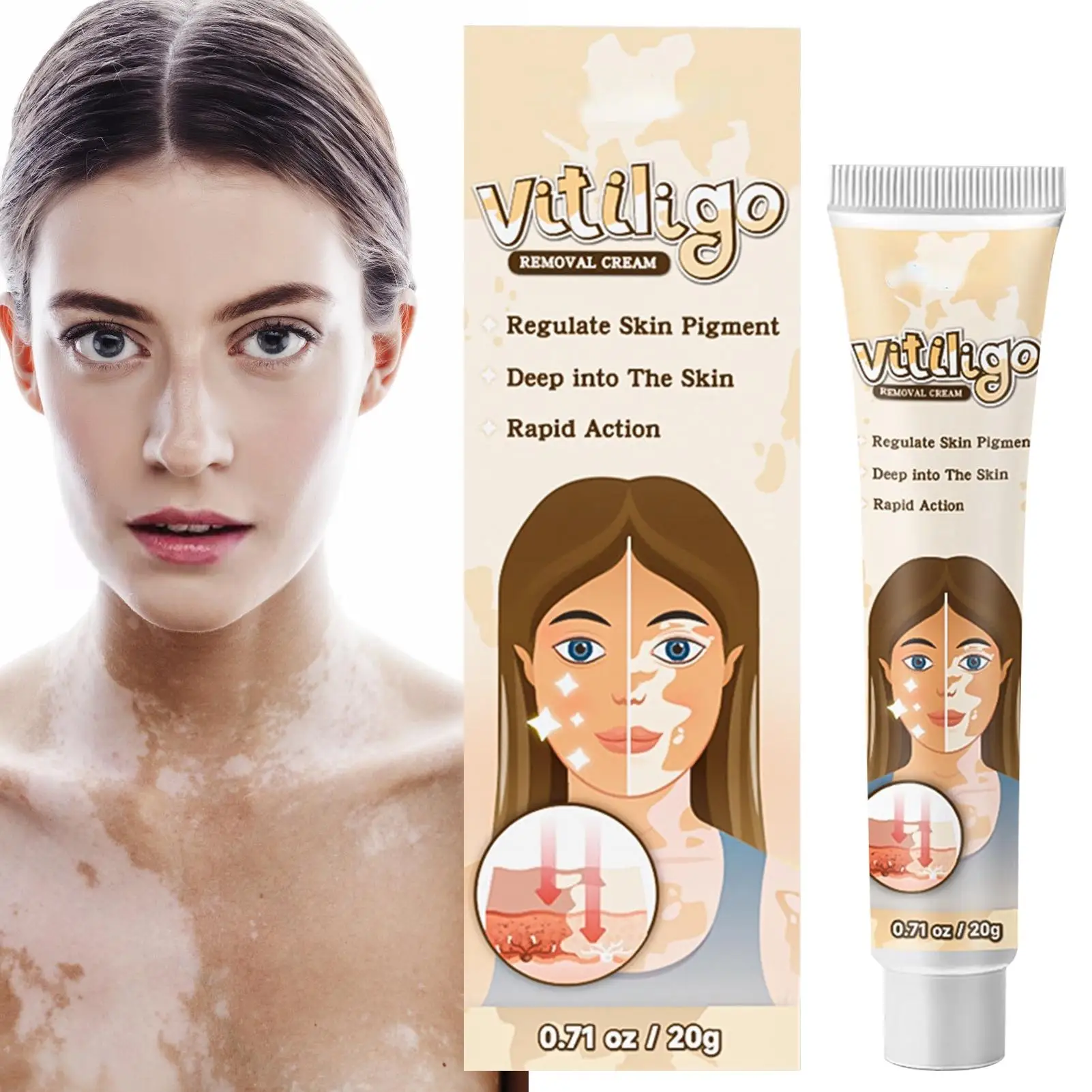 Treament Cream Antibacterials Psoriasiss Localized Ointment Mycosis Leukoplakia Plaster White Spot Cream
Treament Cream Antibacterials Psoriasiss Localized Ointment Mycosis Leukoplakia Plaster White Spot Cream