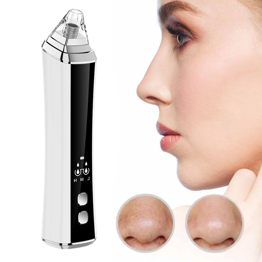 Средство для удаления черных точек, вакуумное электрическое средство для красоты носа, средство для ухода за кожей лица, средство для удале...
Средство для удаления черных точек, вакуумное электрическое средство для красоты носа, средство для ухода за кожей лица, средство для удале...