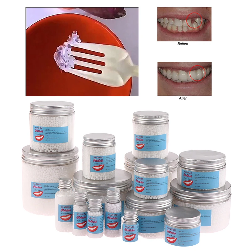 Temporary Tooth Repair Beads Missing Broken Teeth Dental Tooth Filling Material Food Grade False Teeth Solid Glue Denture 
Temporary Tooth Repair Beads Missing Broken Teeth Dental Tooth Filling Material Food Grade False Teeth Solid Glue Denture
