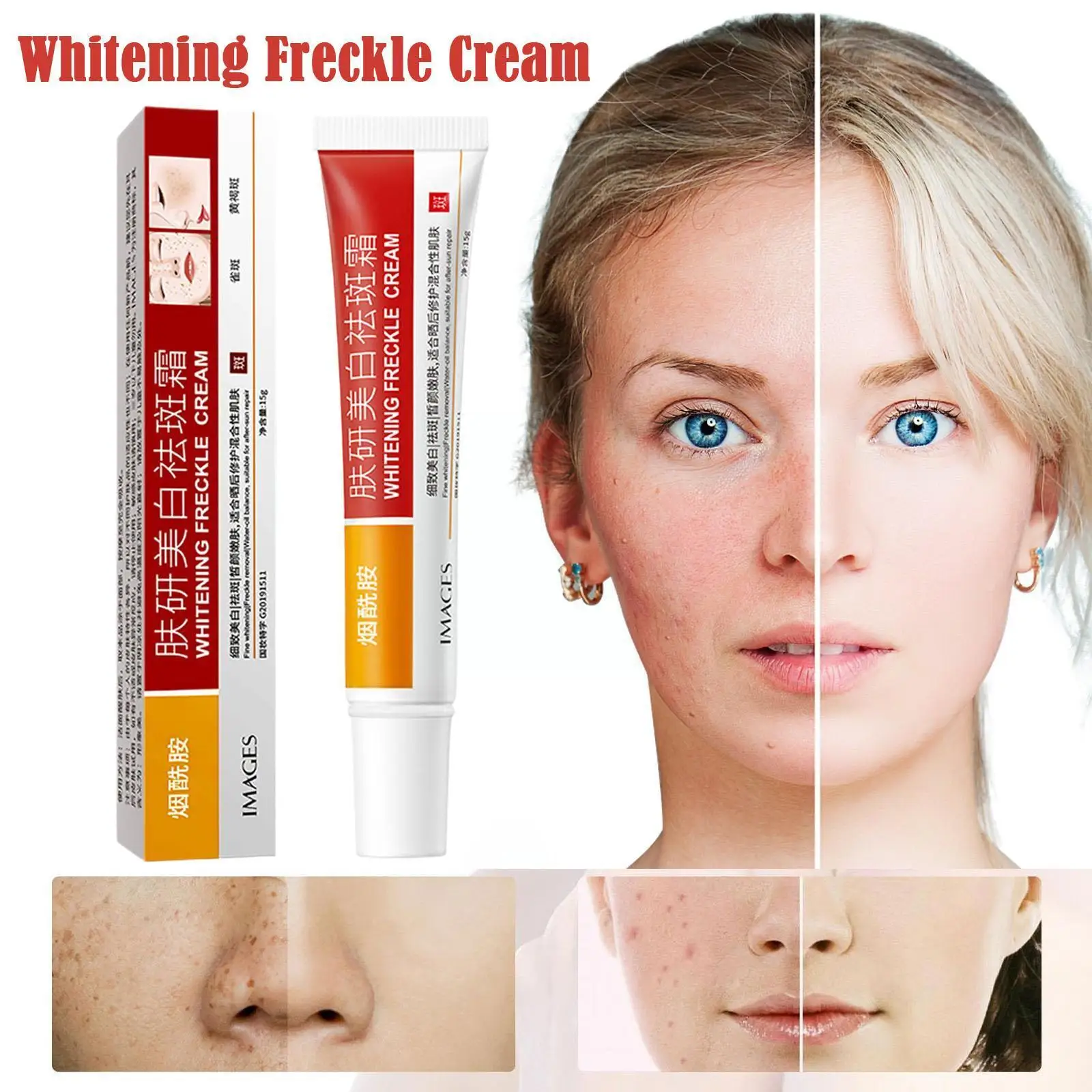 Отбеливающий и веснушный дневной крем для удаления веснушек пигментация де-пятнистых пятен крем Увлажняющий Осветляющий макулярный K1W7
Отбеливающий и веснушный дневной крем для удаления веснушек пигментация де-пятнистых пятен крем Увлажняющий Осветляющий макулярный K1W7