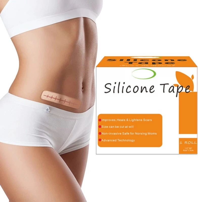 4cm x 1.5cm Norsing Heals Lightens Cut Scar Silicone Strips Wound Dressing Sheets C-Section Surgery Burn Keloid Maternity Tape
4cm x 1.5cm Norsing Heals Lightens Cut Scar Silicone Strips Wound Dressing Sheets C-Section Surgery Burn Keloid Maternity Tape