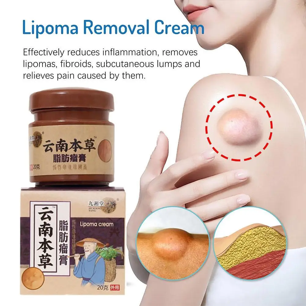 20g Treatment Lipoma Removal Cream Skin Swelling Cellulite Remover Ointment Lipolysis Fat Lump Body Hard Block Removal Medicine
20g Treatment Lipoma Removal Cream Skin Swelling Cellulite Remover Ointment Lipolysis Fat Lump Body Hard Block Removal Medicine