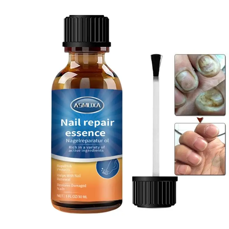 Nail Repair Essence Multi-Purpose Toenail And Fingernail Repair Solution 30g Nail Care Liquid Repair Essence For Damaged Nails
Nail Repair Essence Multi-Purpose Toenail And Fingernail Repair Solution 30g Nail Care Liquid Repair Essence For Damaged Nails