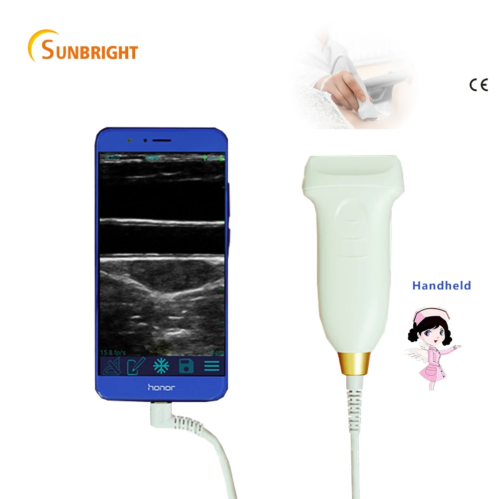 Cheap Price Handheld USB Medical Ultrasound Linear Probe SUN-P2 
Cheap Price Handheld USB Medical Ultrasound Linear Probe SUN-P2