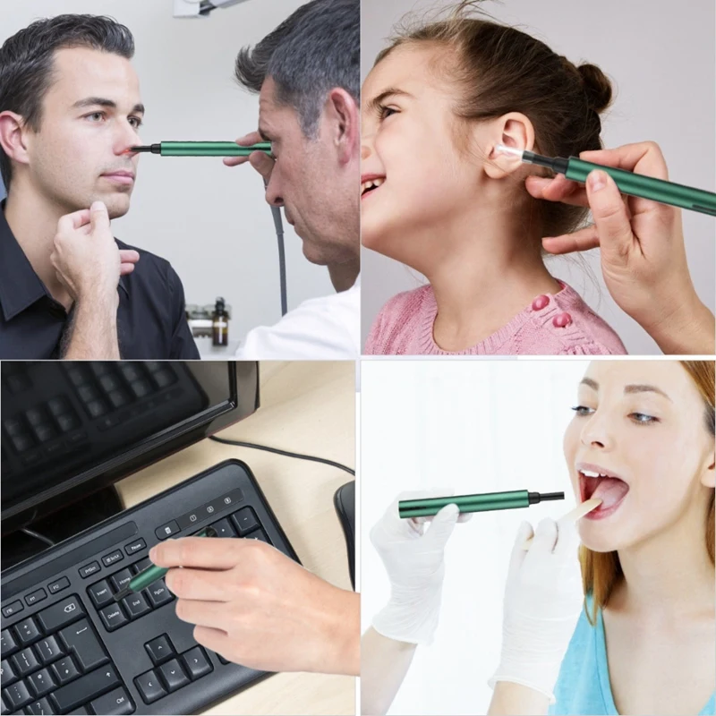 HOT-Wireless Wifi Ear Pick Otoscope Camera Borescope Luminous Ear Wax Cleaning Teeth Oral Inspection Health Care 3.0/5.0MP
HOT-Wireless Wifi Ear Pick Otoscope Camera Borescope Luminous Ear Wax Cleaning Teeth Oral Inspection Health Care 3.0/5.0MP