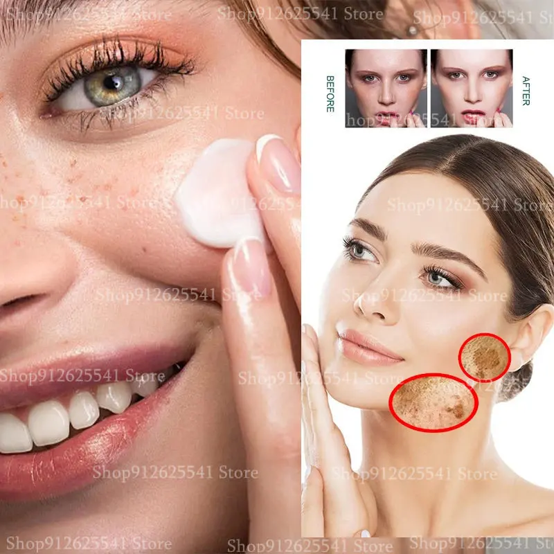 Removes Dark Spot Age Spots Niacinamide Facial Day Cream Effectively Whitening Brightening Chloasma Spots Freckles Skin Care
Removes Dark Spot Age Spots Niacinamide Facial Day Cream Effectively Whitening Brightening Chloasma Spots Freckles Skin Care