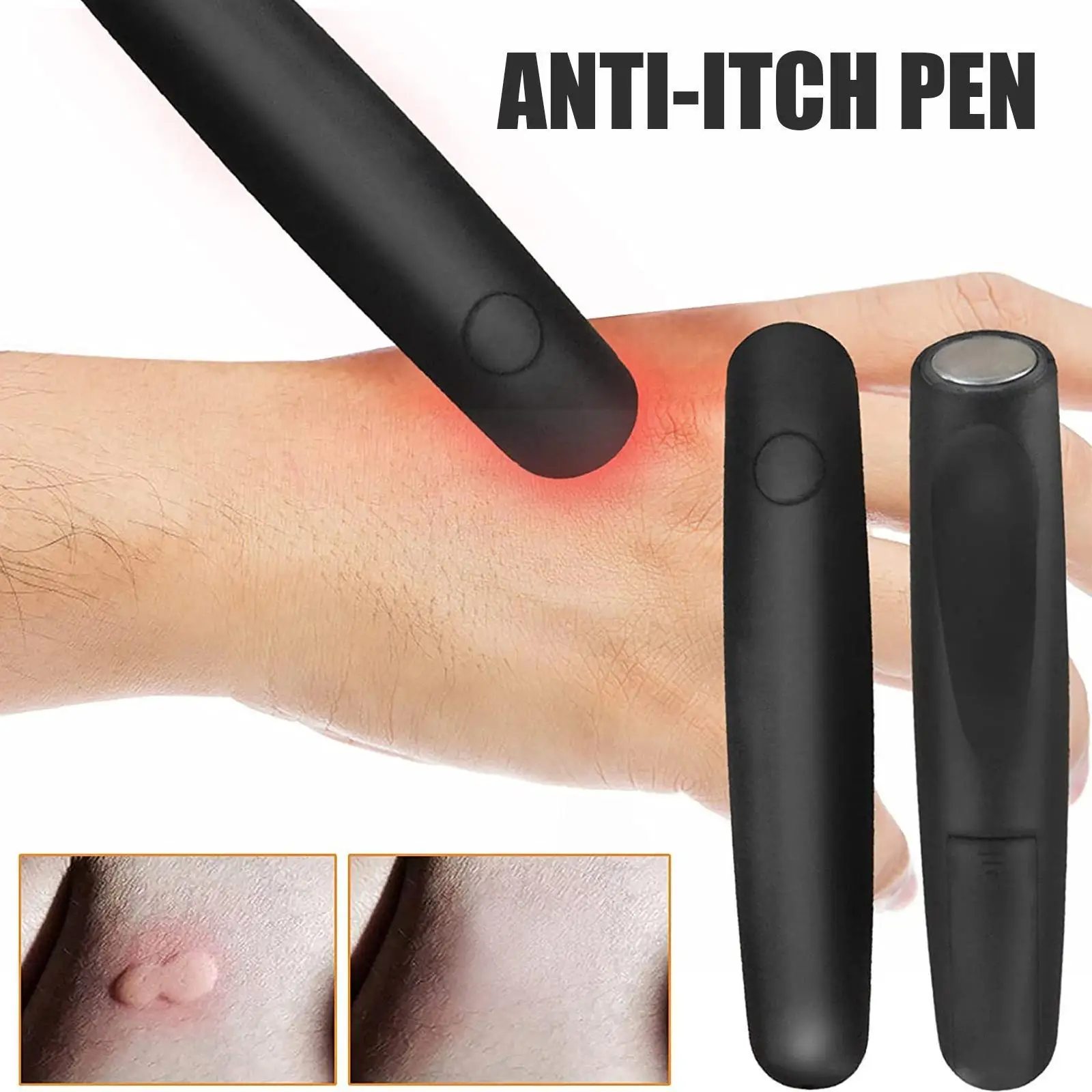 New Portable Mosquito Insect Bite Relieve Itching Pen For Children Adult Antipruritic Stick Physical Anti-itch Supplies K7U0
New Portable Mosquito Insect Bite Relieve Itching Pen For Children Adult Antipruritic Stick Physical Anti-itch Supplies K7U0