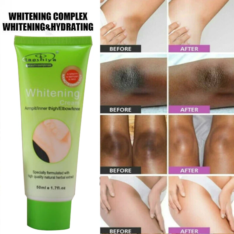 Aichun 50 г отбеливающий крем для тела, темная кожа, подмышка, осветляющее колено, бикини, подмышка, внутреннее бедро, хит продаж, высокое качеств... 
Aichun 50 г отбеливающий крем для тела, темная кожа, подмышка, осветляющее колено, бикини, подмышка, внутреннее бедро, хит продаж, высокое качеств...