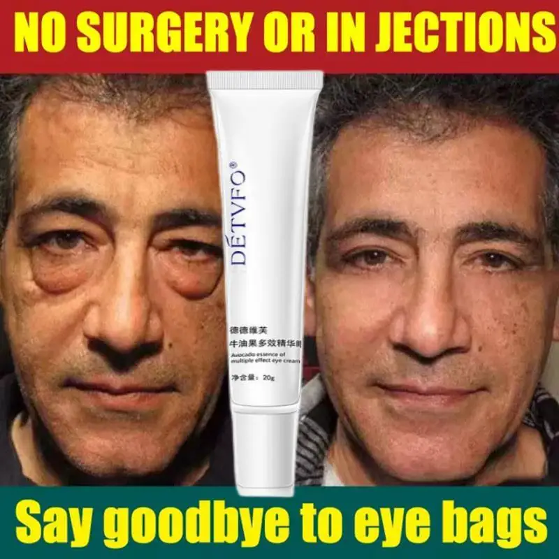 Instant Wrinkle Removal Eye Cream Anti Aging Remove Dark Circles Bags Puffiness Fade Eye Fine Line Skin Face Tighten Korean Care
Instant Wrinkle Removal Eye Cream Anti Aging Remove Dark Circles Bags Puffiness Fade Eye Fine Line Skin Face Tighten Korean Care