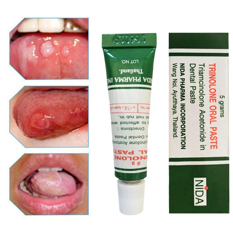 Thailand Oral ulcers Cream Herbal Mouth Ulcer Pain Relief Antibacterial Cream Inflammation Toothache Tongue Dental Care Cream 5g
Thailand Oral ulcers Cream Herbal Mouth Ulcer Pain Relief Antibacterial Cream Inflammation Toothache Tongue Dental Care Cream 5g