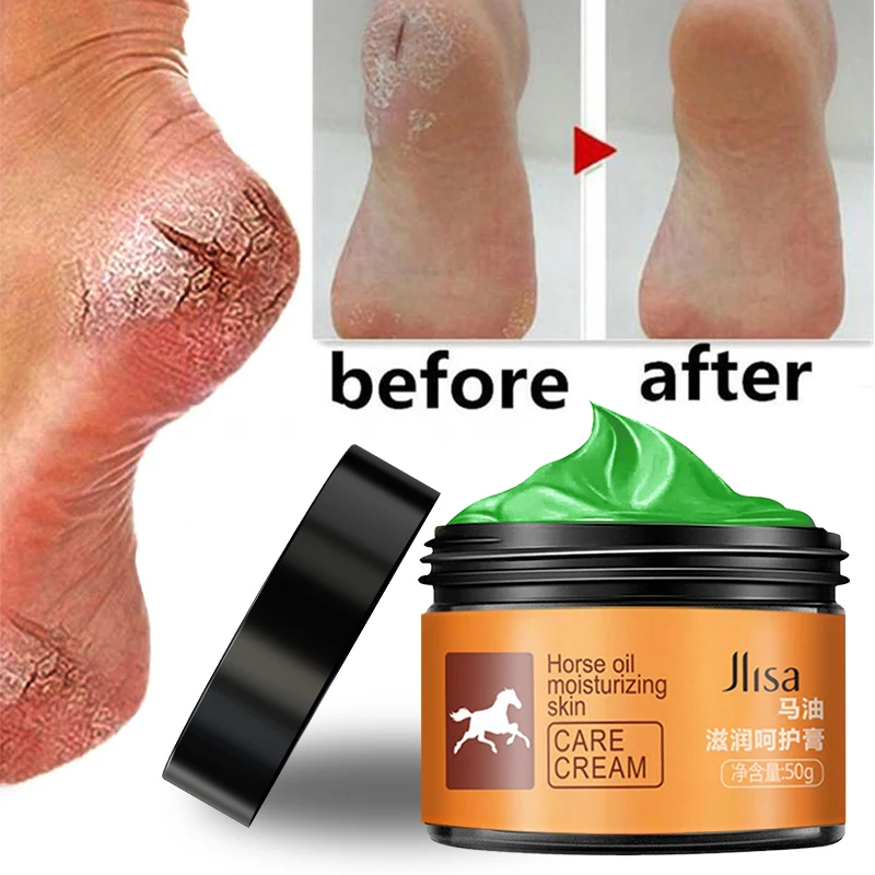 Equine oil foot care ointment crack repair foot cream equine Oil Face Cream Anti drying smooth cracked heel face cream,
Equine oil foot care ointment crack repair foot cream equine Oil Face Cream Anti drying smooth cracked heel face cream,