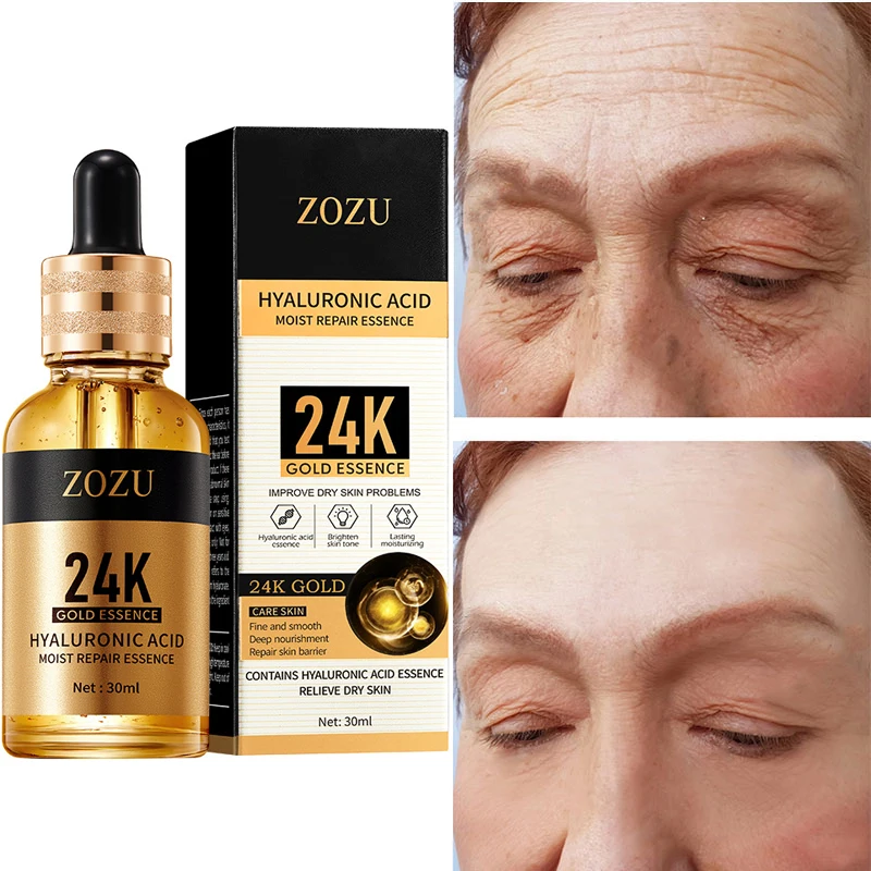 24k Gold Wrinkle Remover Serum Fade Fine Lines Deep Nourish Repair Skin Barrier Hyaluronic Acid Moisturizing Brighten Face Care
24k Gold Wrinkle Remover Serum Fade Fine Lines Deep Nourish Repair Skin Barrier Hyaluronic Acid Moisturizing Brighten Face Care