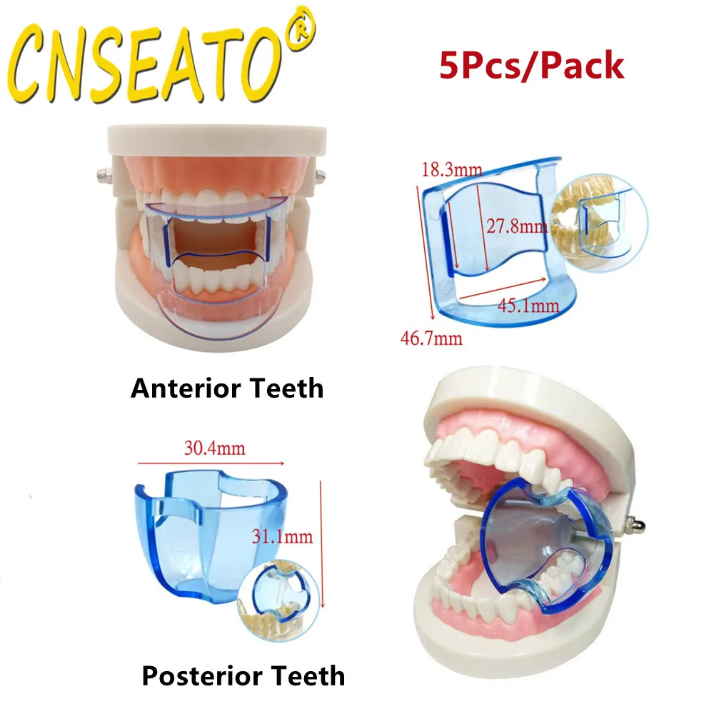 5 шт., ортодонтический ремешок для зубов, губ
5 шт., ортодонтический ремешок для зубов, губ