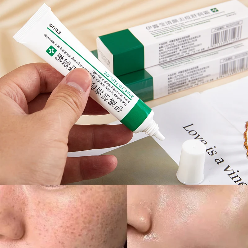 Effective Acne Removal Cream Acne Treatment Fade Acne Spots Oil Control Shrink Pores Whitening Moisturizing Acne Cream Skin Care
Effective Acne Removal Cream Acne Treatment Fade Acne Spots Oil Control Shrink Pores Whitening Moisturizing Acne Cream Skin Care