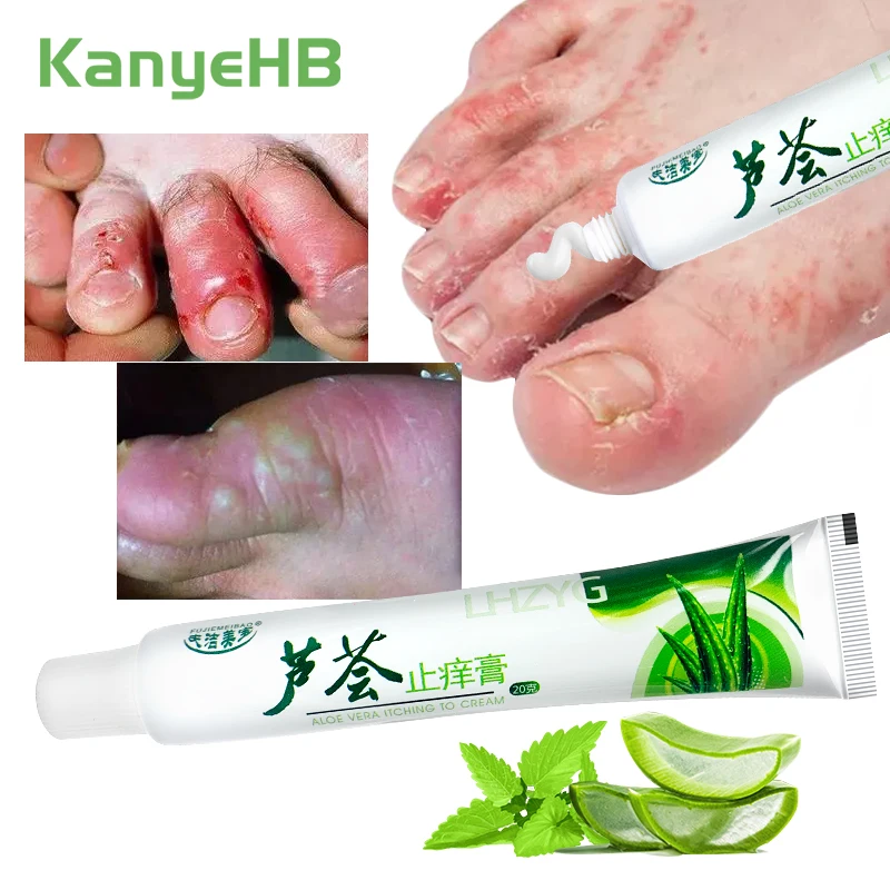 1Pcs Psoriasis Anti-Itch Cream Against Fungi Relief Pain Allergic Neurodermatitis Rash Tinea Pedis Herb Treatment Ointment S080
1Pcs Psoriasis Anti-Itch Cream Against Fungi Relief Pain Allergic Neurodermatitis Rash Tinea Pedis Herb Treatment Ointment S080