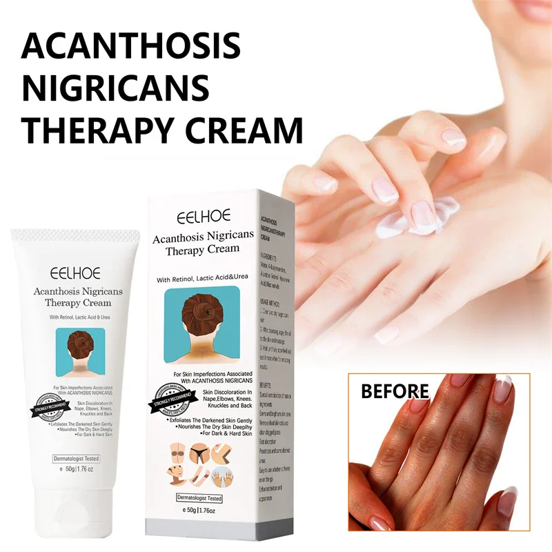 Body Whitening Cream Intimate Essence Underarm Knee Butt Dullness Brighten Improve Lip Remove Melanin Moisturizer Body Care 50g
Body Whitening Cream Intimate Essence Underarm Knee Butt Dullness Brighten Improve Lip Remove Melanin Moisturizer Body Care 50g