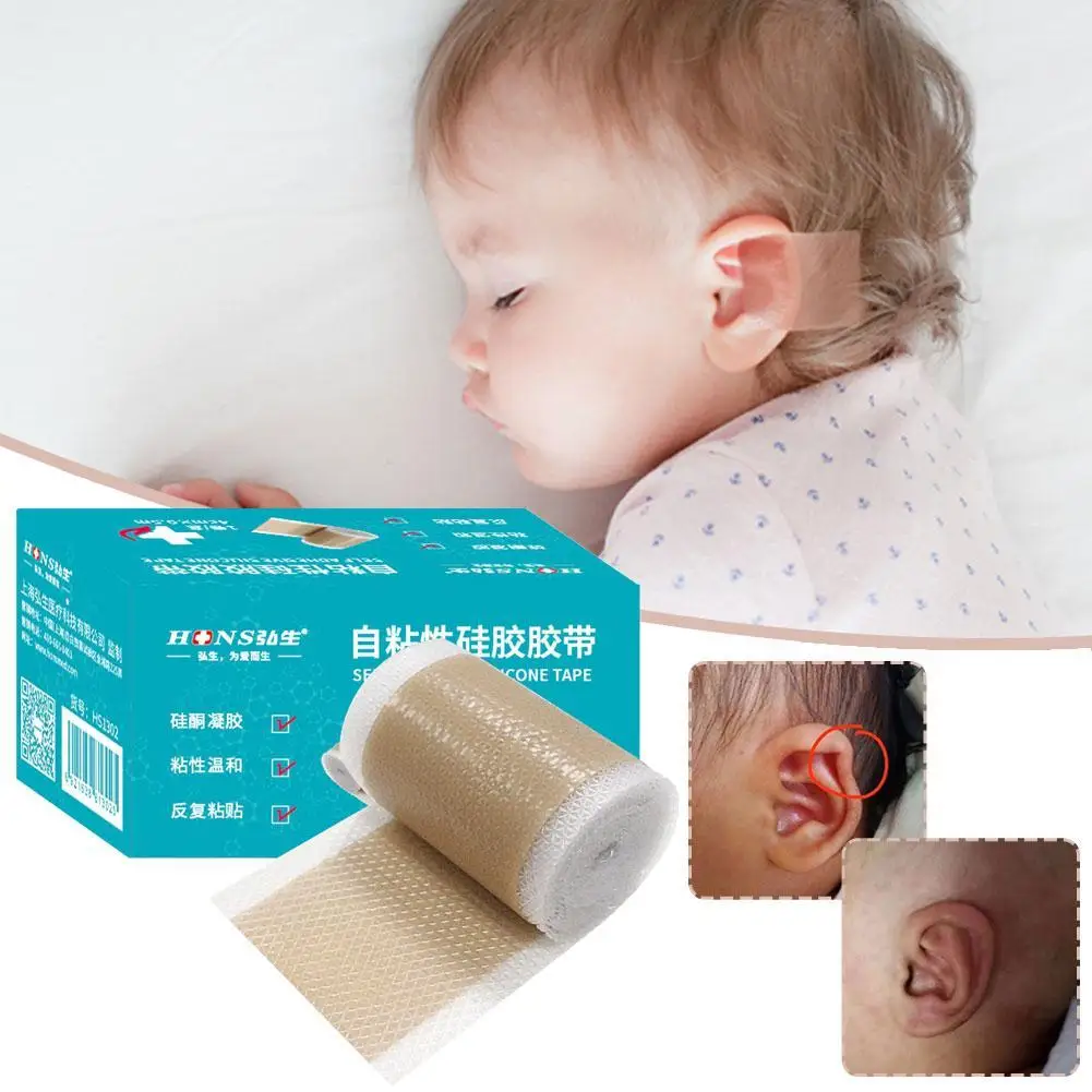 

4x50cm Silicone Scars Patch Wounds Band Remove Acne Burn Scar Treatment Cover Ear Correctors Efficient Repair Damaged Skin Sheet