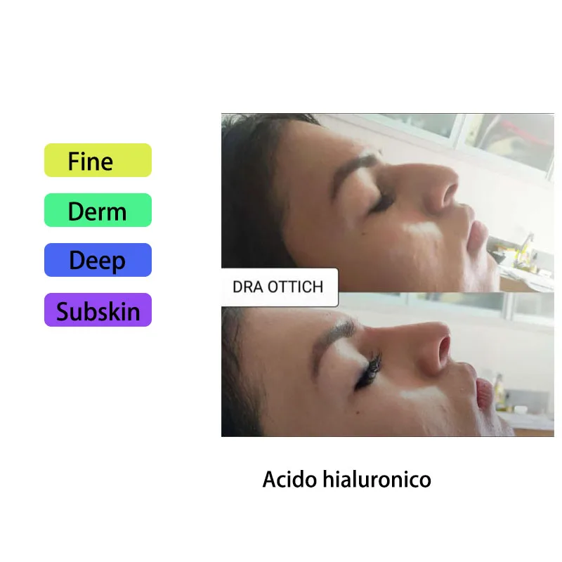 1 шт., увлажняющая Гиалуроновая кислота для губ, 5/10 мл
1 шт., увлажняющая Гиалуроновая кислота для губ, 5/10 мл