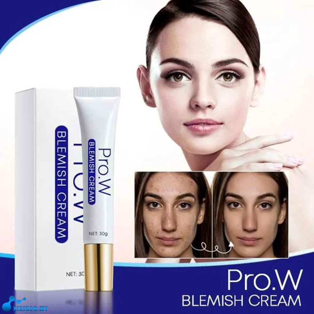 Pro.W Blemishs Cream Removal Cream Whitening Cream Rich in Niacinamide Dilute Spots Remove Acne Improve Dark Yellow Skin Brighte
Pro.W Blemishs Cream Removal Cream Whitening Cream Rich in Niacinamide Dilute Spots Remove Acne Improve Dark Yellow Skin Brighte