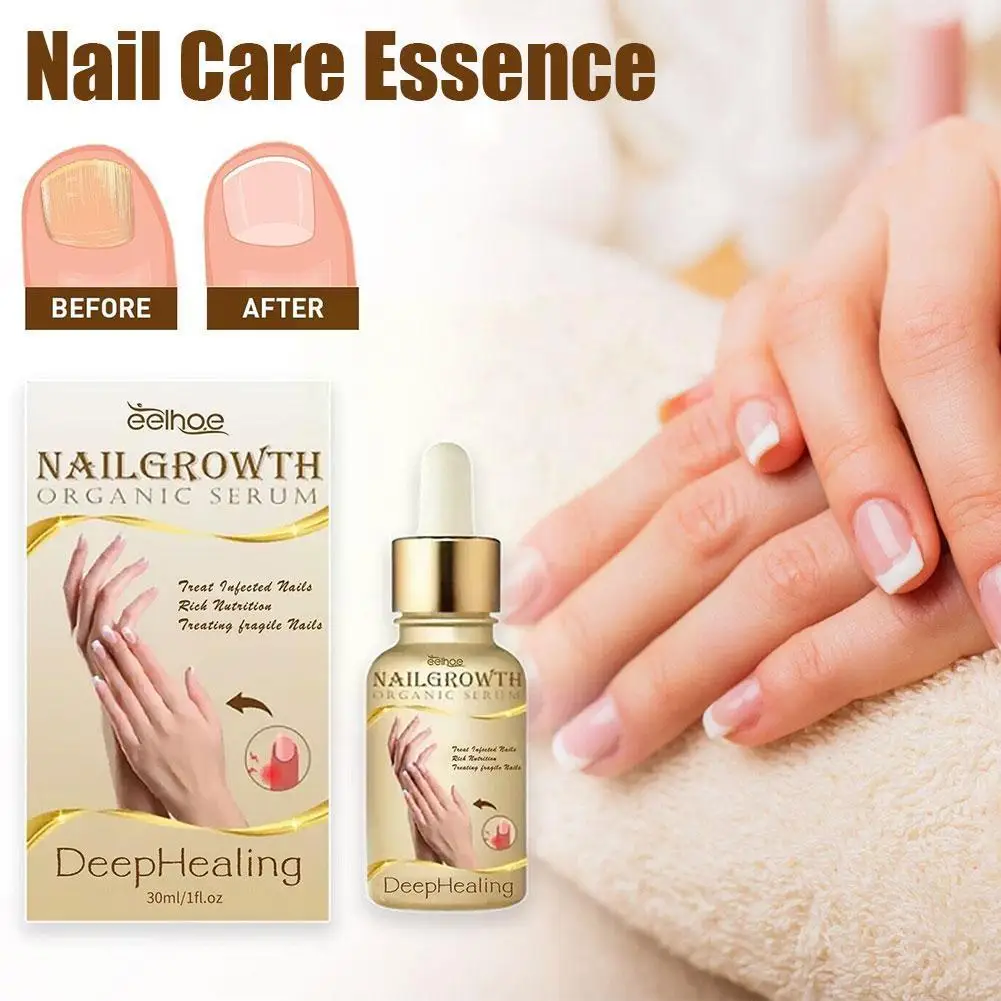 Nailgrowth Deephealing Serum Nail Growth And Strengthening Fix Renew Damage Nail Goods For Manicure All R5R6
Nailgrowth Deephealing Serum Nail Growth And Strengthening Fix Renew Damage Nail Goods For Manicure All R5R6