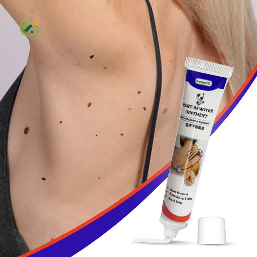 3/5Pcs Warts Remover Antibacterial Ointment Wart Treatment Cream Skin Tag Remover Genital Herpes Papillomas Treatment Ointment
3/5Pcs Warts Remover Antibacterial Ointment Wart Treatment Cream Skin Tag Remover Genital Herpes Papillomas Treatment Ointment