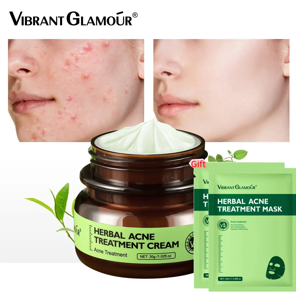 

Acne Removal Day Cream Herbal Scar Spots Facial Remove Pimple Treatment Cream Anti-Acne Face Gel Oil Control Shrink Pores 30g