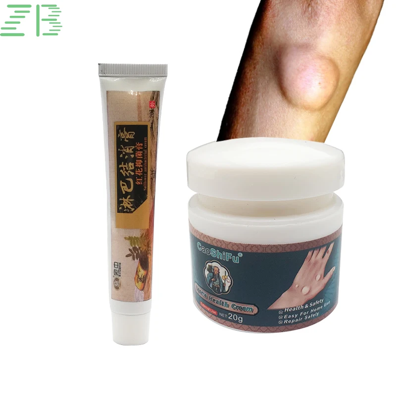 2 типа ZB Lipoma крем для удаления жира кусочки мазь нодулярный дискомфорт крем для снятия симптомов боли в коже и отеках медицинский пластырь
2 типа ZB Lipoma крем для удаления жира кусочки мазь нодулярный дискомфорт крем для снятия симптомов боли в коже и отеках медицинский пластырь