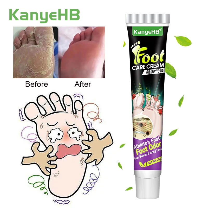 1Pcs Athlete's Foot Cream Anti Fungal Infections Relieve Foot Itching Erosion Peeling Beriberi Tinea Pedis Medical Ointment G027
1Pcs Athlete's Foot Cream Anti Fungal Infections Relieve Foot Itching Erosion Peeling Beriberi Tinea Pedis Medical Ointment G027