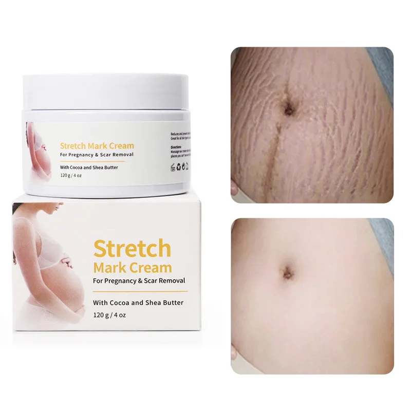 Pregnancy Repair Cream Stretch Mark Removal Acne Scar Stretch Marks Cream Pregnant Women Stretch Marks Treatment Creams 50g/120g
Pregnancy Repair Cream Stretch Mark Removal Acne Scar Stretch Marks Cream Pregnant Women Stretch Marks Treatment Creams 50g/120g