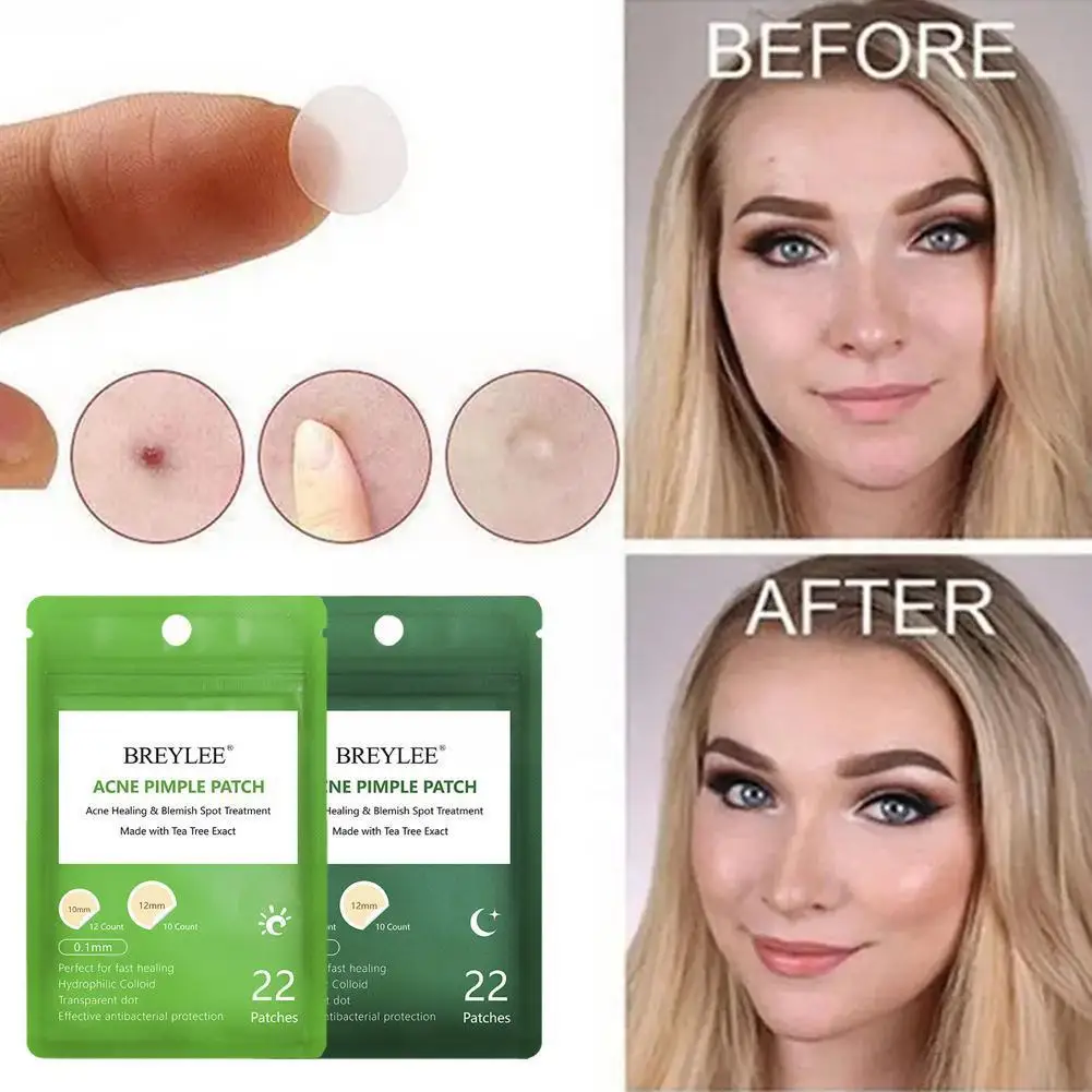 Acne Pimple Patch Stickers Acne Treatment Pimple Remover Patches Tool Skin 22 Facial Mask Spot Blemish Waterproof Care D5X9
Acne Pimple Patch Stickers Acne Treatment Pimple Remover Patches Tool Skin 22 Facial Mask Spot Blemish Waterproof Care D5X9