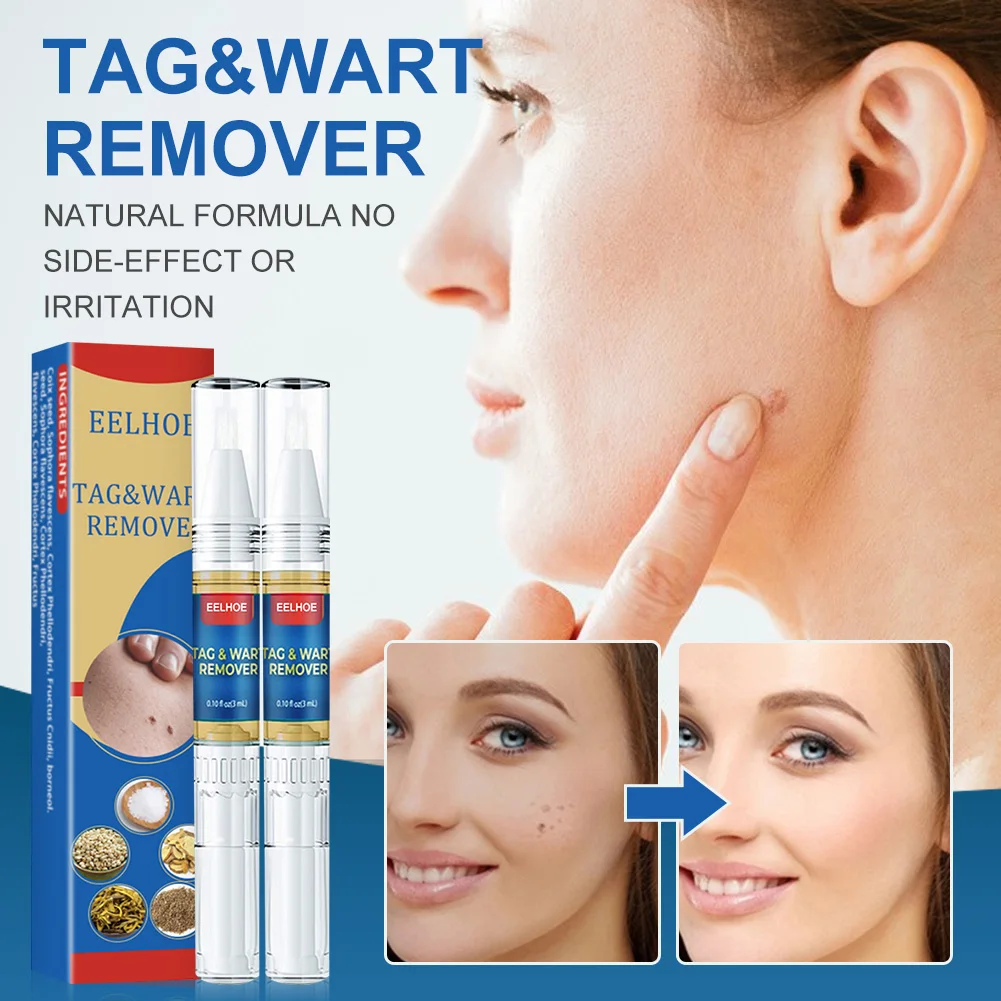 3ml Skin Tag Remover Pen Painless Fast Drying Quickly Remove Skin Tags Wart Callus Natural Wart Removal Pen For All Skin Types
3ml Skin Tag Remover Pen Painless Fast Drying Quickly Remove Skin Tags Wart Callus Natural Wart Removal Pen For All Skin Types