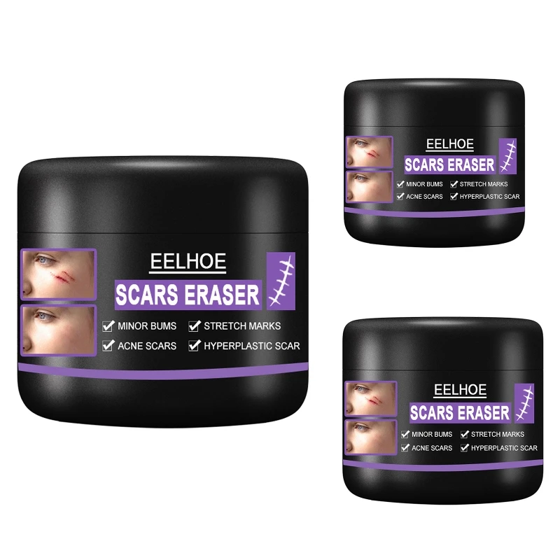 10/30/50g Scar Repair Cream Acne Scar Removal Pigmentation Corrector Remove Stretch Marks Smooth Skin Whitening Scar Care
10/30/50g Scar Repair Cream Acne Scar Removal Pigmentation Corrector Remove Stretch Marks Smooth Skin Whitening Scar Care