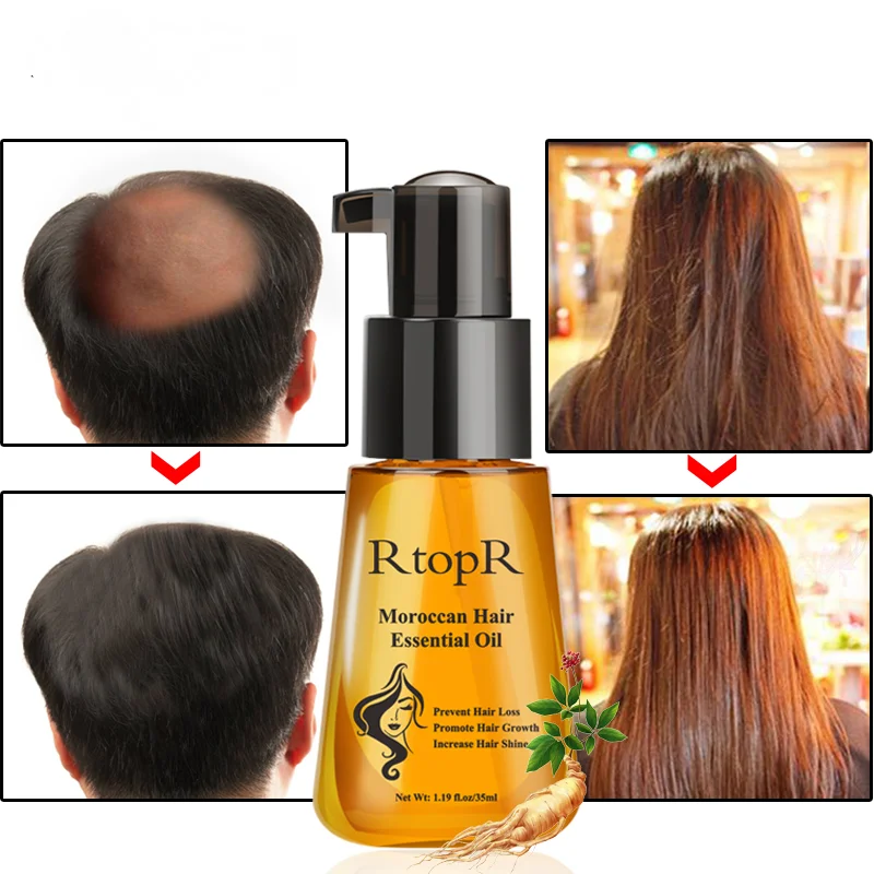 Hot Sale 35ml Liquid Fast Hair Growth Essential Oil Prevent Hair Loss Product Women Men Beauty Hair Care Treatment Essence
Hot Sale 35ml Liquid Fast Hair Growth Essential Oil Prevent Hair Loss Product Women Men Beauty Hair Care Treatment Essence