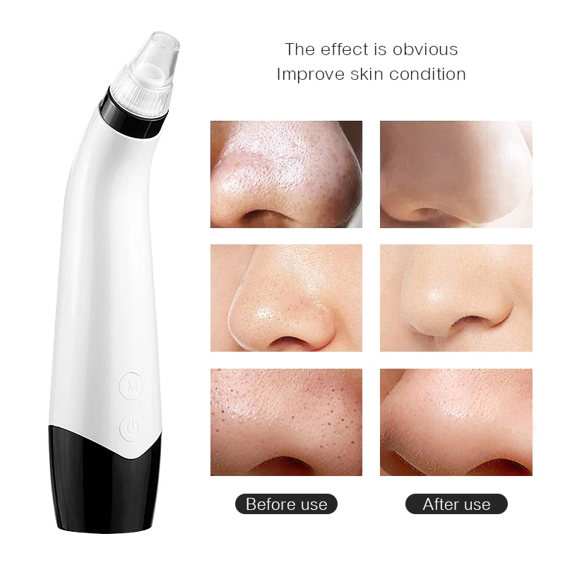 Blackhead Cleaning Electric Cleansing Instrument Home Beauty Instrument Skin Care Tools Pore Cleansing To Remove Acne 42D
Blackhead Cleaning Electric Cleansing Instrument Home Beauty Instrument Skin Care Tools Pore Cleansing To Remove Acne 42D