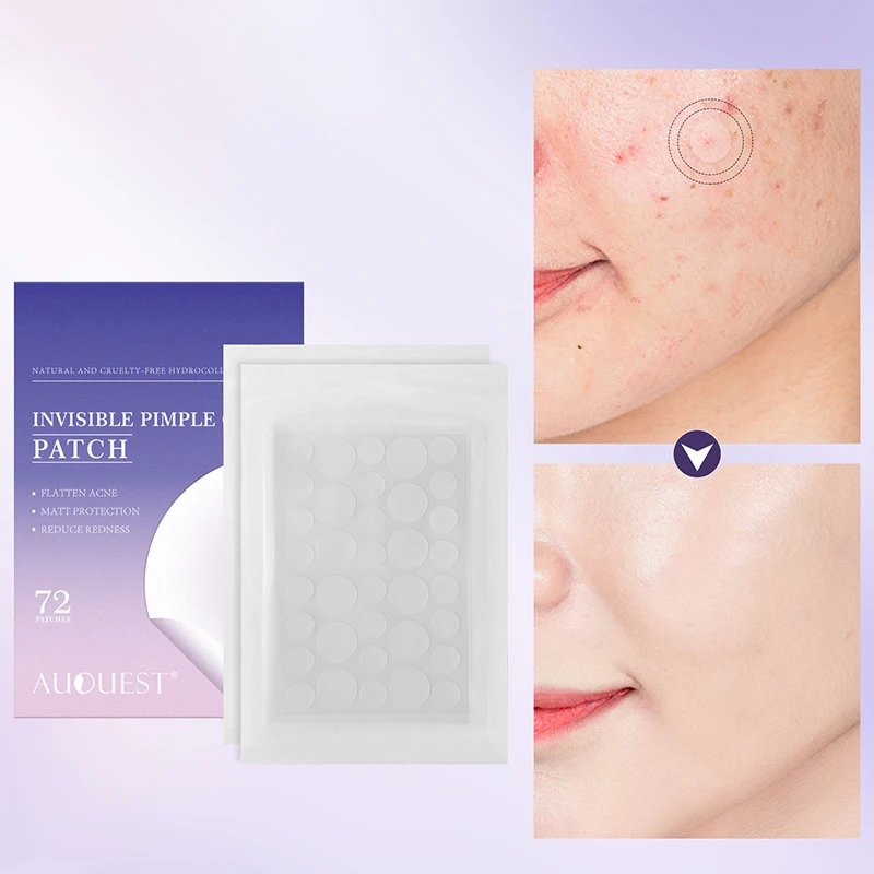 New Tea Tree Salicylic Acid Acne Patch 72 Patches Invisible Anti-acne Mild And Non-irritating Concealer Masks Beauty Health
New Tea Tree Salicylic Acid Acne Patch 72 Patches Invisible Anti-acne Mild And Non-irritating Concealer Masks Beauty Health