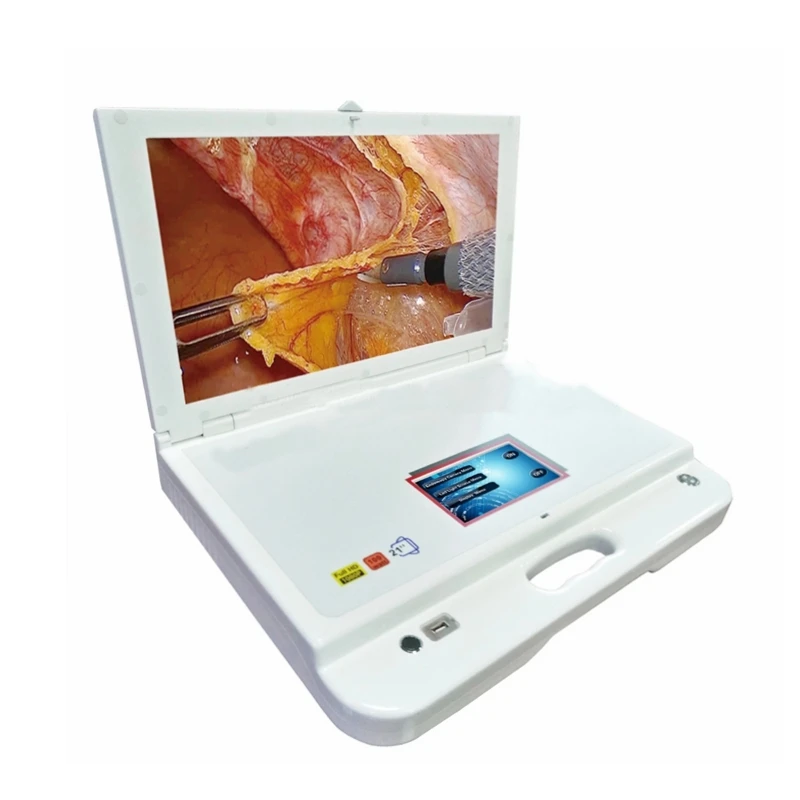 Portable optical Endoscope with accessories type nasal endoscopy camera for ENT
Portable optical Endoscope with accessories type nasal endoscopy camera for ENT