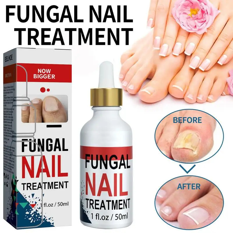 Лосьон для ухода за ногтями, 50 мл
Лосьон для ухода за ногтями, 50 мл