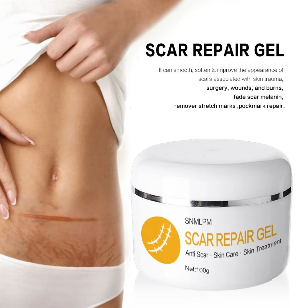 Scar Repair Cream Acne Scars Remove Gel Fade Stretch Marks Acnes Spots Burn Surgical Scars Treatment Serum Smooth Body Skin Care
Scar Repair Cream Acne Scars Remove Gel Fade Stretch Marks Acnes Spots Burn Surgical Scars Treatment Serum Smooth Body Skin Care