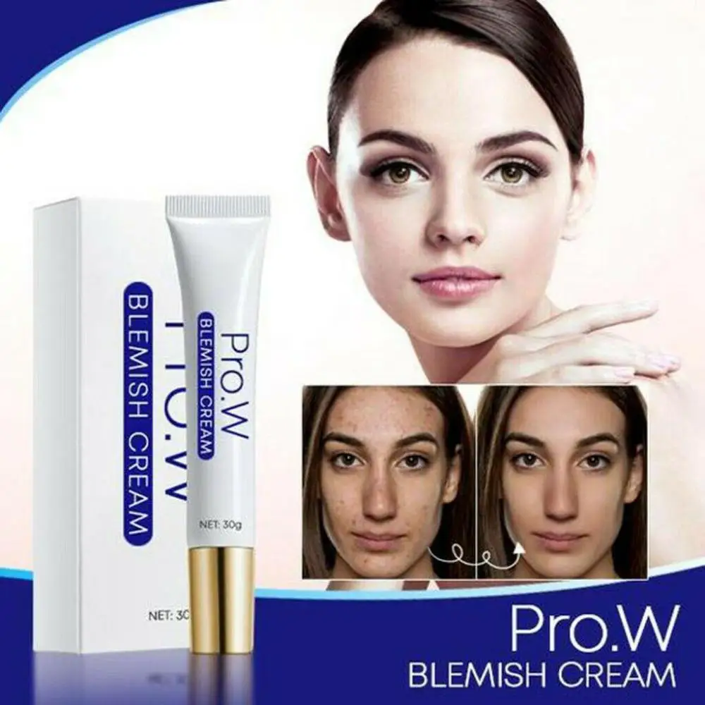Blemish Cream Freckles Spot Removal Pimple Ointment Water-oil Balance Acne Cream Moisturizing Skin Cream Blemish Cream Care Tool
Blemish Cream Freckles Spot Removal Pimple Ointment Water-oil Balance Acne Cream Moisturizing Skin Cream Blemish Cream Care Tool