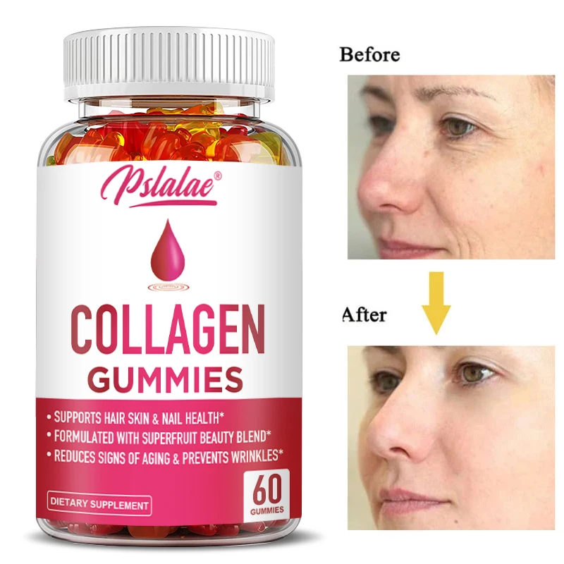 Women's Collagen Gummies - with Type 1 & 3 Collagen, Vitamins & Superfruit Beauty Blend - Hair Nails & Skin Vitamins 60 Gummies
Women's Collagen Gummies - with Type 1 & 3 Collagen, Vitamins & Superfruit Beauty Blend - Hair Nails & Skin Vitamins 60 Gummies