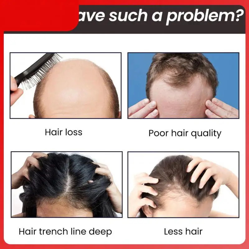 Hair Care Essential Oil Prevent Hair Loss Oil Powerful Effect Hair Growth Hair Growth Oil Head Scalp 30ml Hair Care
Hair Care Essential Oil Prevent Hair Loss Oil Powerful Effect Hair Growth Hair Growth Oil Head Scalp 30ml Hair Care