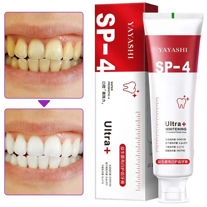 

Probiotic Caries Toothpaste SP-4 Whitening Tooth Decay Repair Paste Teeth Cleaner Plaque Remover Fresh Breath Dental Care 120g