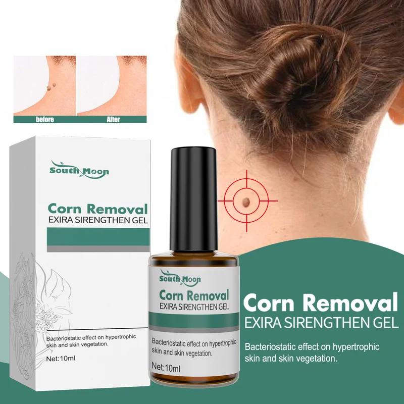 South Moon Remove Warts To Remove Corns To Remove Meat Thorns Flat Warts Plantar Warts Filamentous Warts Gram Wart Liquid
South Moon Remove Warts To Remove Corns To Remove Meat Thorns Flat Warts Plantar Warts Filamentous Warts Gram Wart Liquid
