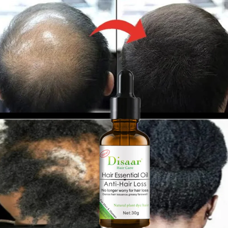 Strengthen Hair To Improve Itchy Split Ends Care, Dye and Perm Damage Care, Improve Frizzy Hair Essential Oil Scalp Treatment
Strengthen Hair To Improve Itchy Split Ends Care, Dye and Perm Damage Care, Improve Frizzy Hair Essential Oil Scalp Treatment