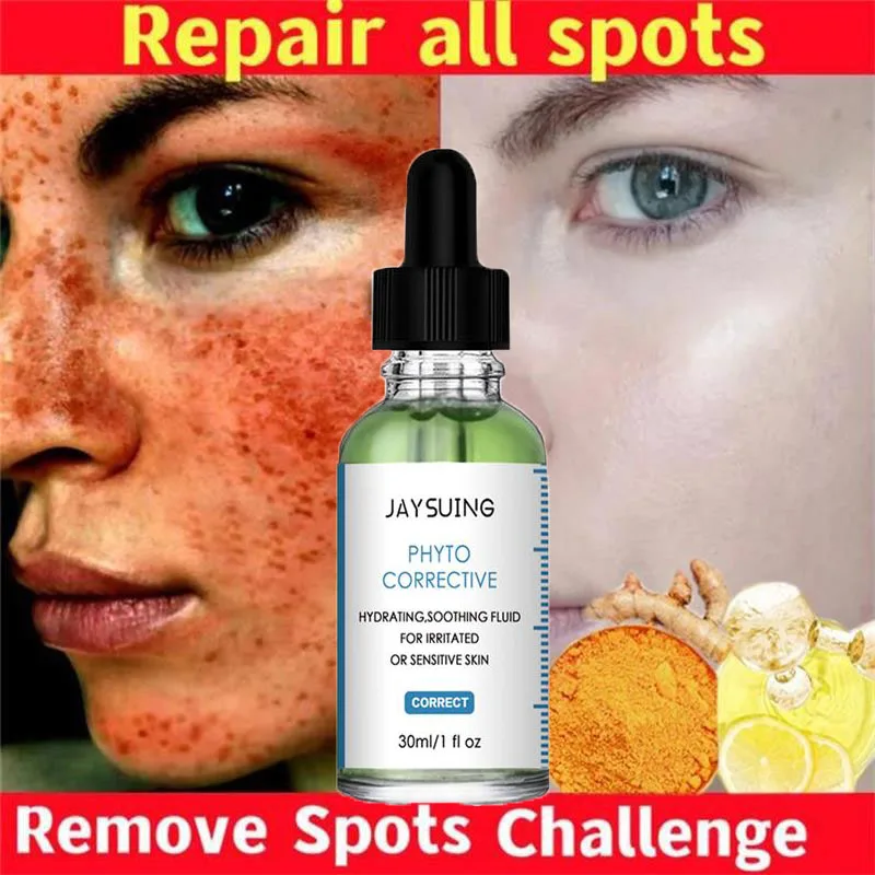 10pcs Whitening Freckle Serum Effective Remove Dark Spot Melanin Sunspots Whiten Brighten Essence Anti Aging Skin Care Products
10pcs Whitening Freckle Serum Effective Remove Dark Spot Melanin Sunspots Whiten Brighten Essence Anti Aging Skin Care Products