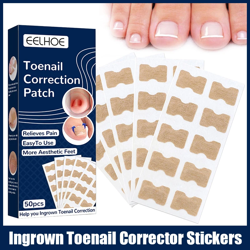 50 шт., корректор для вросших ног
50 шт., корректор для вросших ног